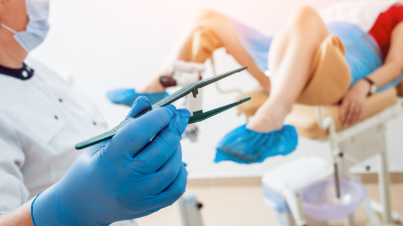 RFSU: Screena kvinnor över 64 år för livmoderhalscancer